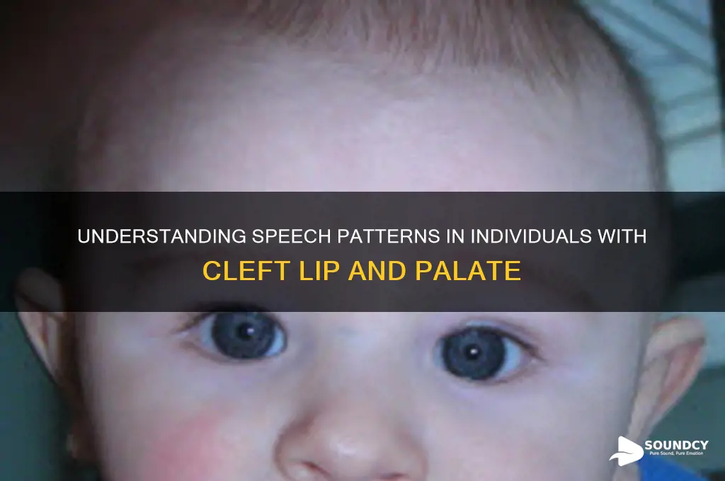 how do people with cleft lip and palate sound