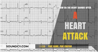 Post-Heart Attack Heart Sounds: What to Expect and Why They Matter