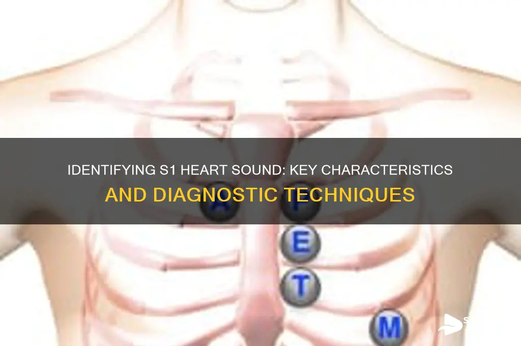 how do you determine which heart sound is s1