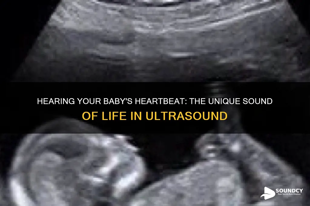 how does a babys heartbeat sound in an ultrasound