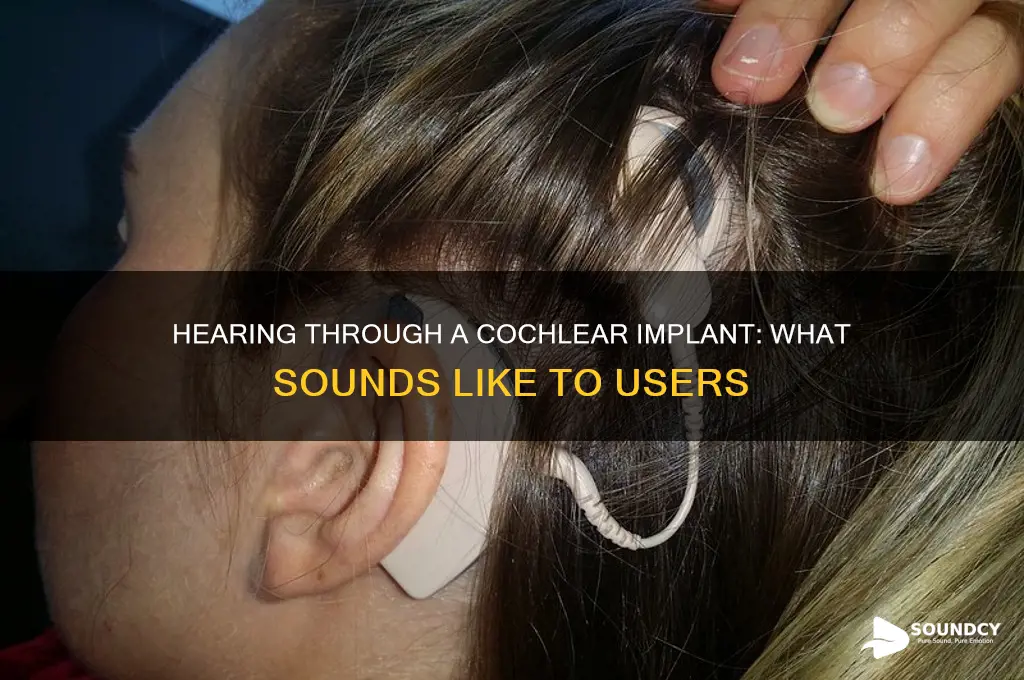 how does a cochlear inplant sound