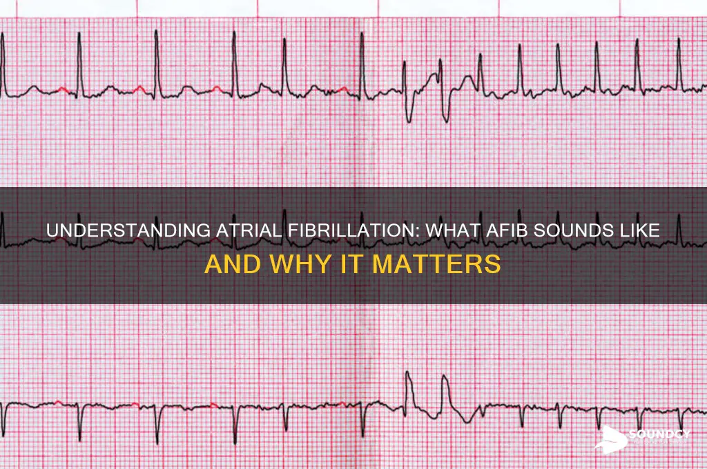 how does afib sound like