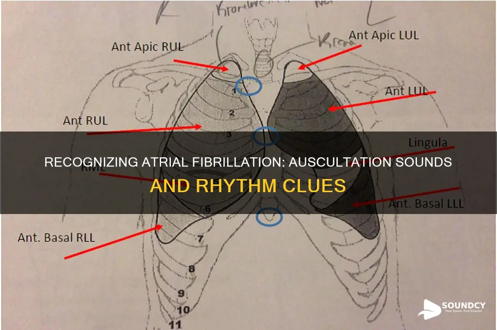 how does afib sound on auscultation
