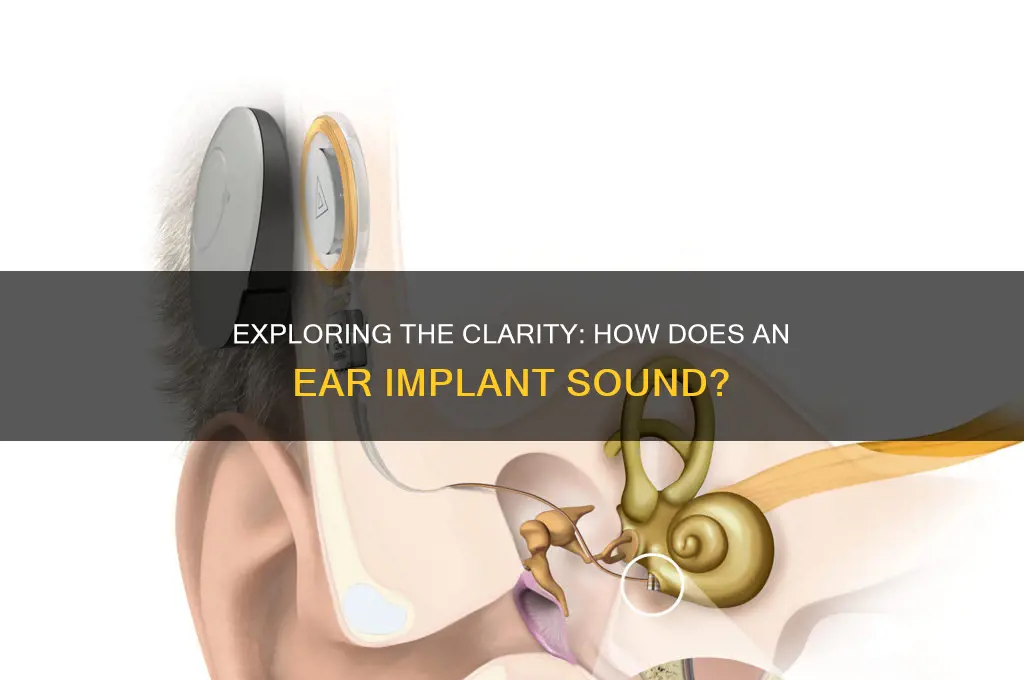 how does an ear implant sound