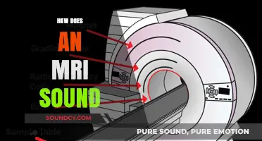Unveiling the Noisy Mystery: What Does an MRI Sound Like?