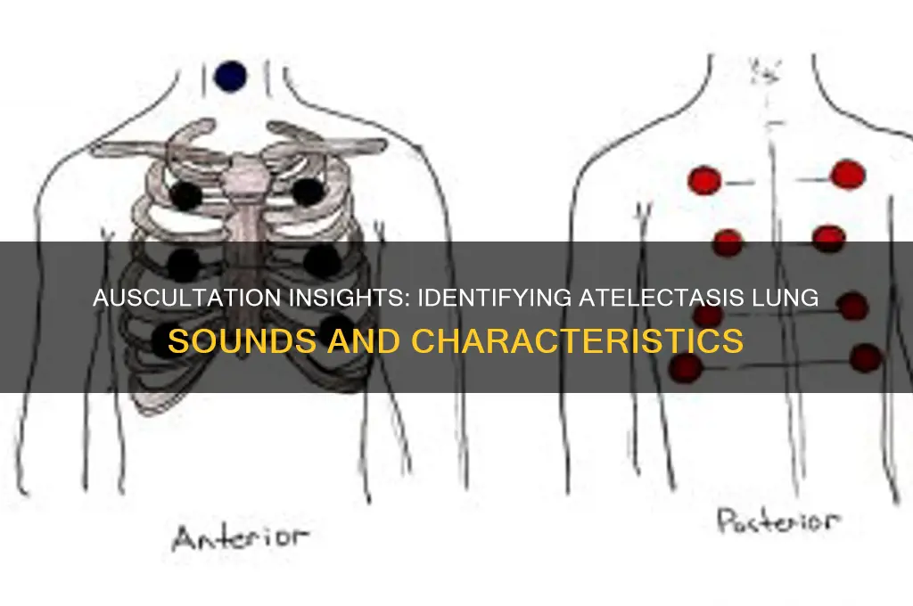 how does atelectasis sound on auscultation