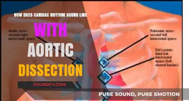 Unraveling the Unique Cardiac Rhythm Sounds in Aortic Dissection Cases