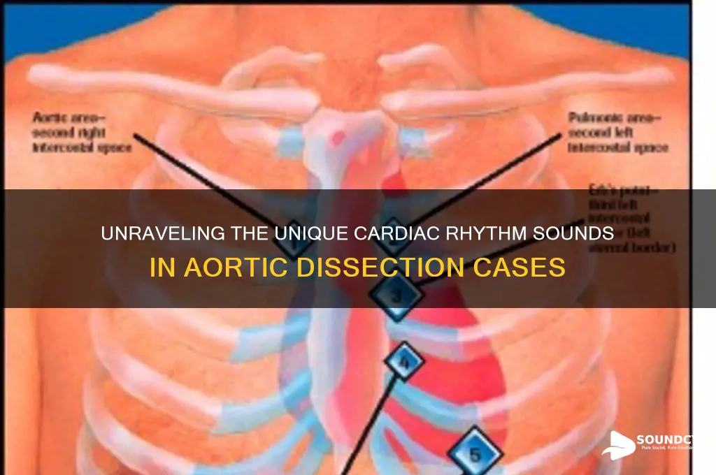 how does cardiac rhythm sound like with aortic dissection