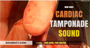 Understanding Cardiac Tamponade: Auscultation Sounds and Clinical Significance