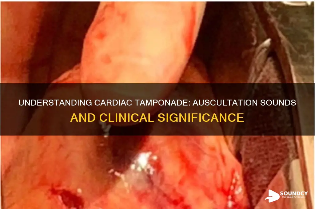 how does cardiac tamponade sound