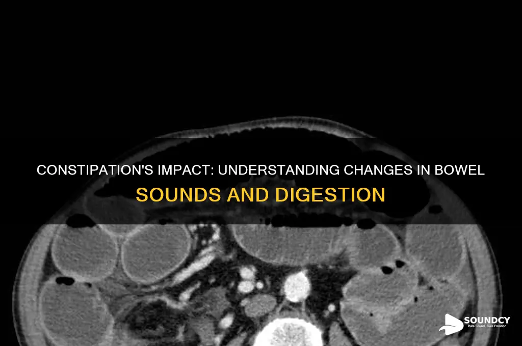 how does constipation affect bowel sounds