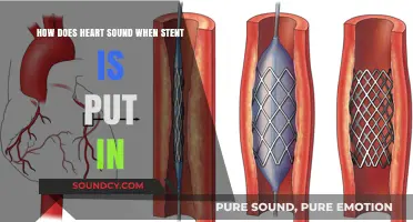 Heart Sounds Post-Stent: What to Expect During Recovery