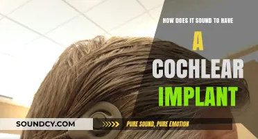 Hearing Redefined: The Transformative Experience of Cochlear Implants