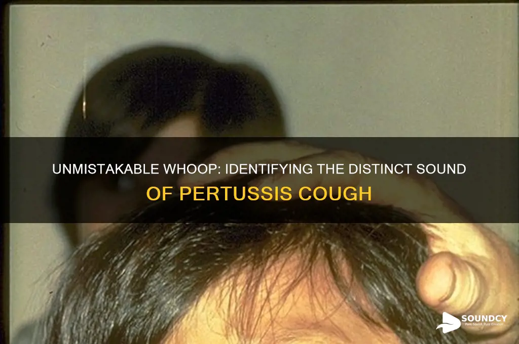 how does pertussis cough sound