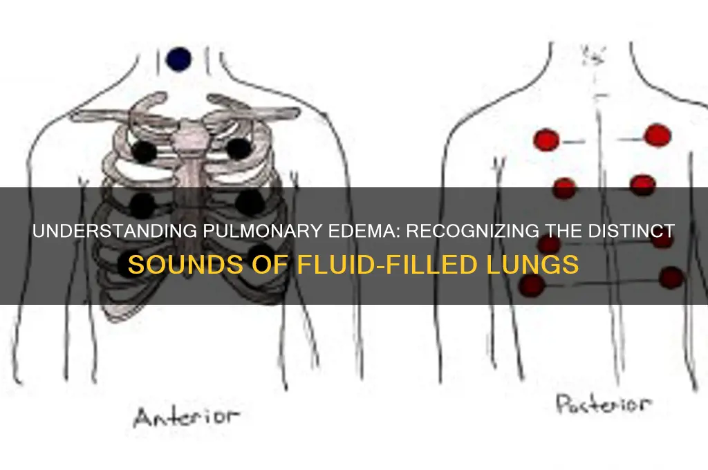 how does pulmonary edeme sound