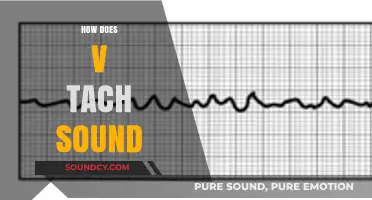 Understanding V-Tach: What Does Ventricular Tachycardia Sound Like?