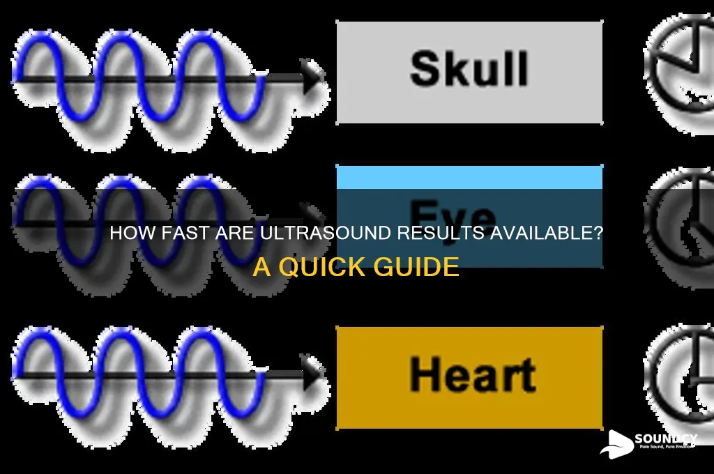 how fast ultra sound results