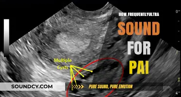 How Often Should You Get an Ultrasound for Pelvic Pain?