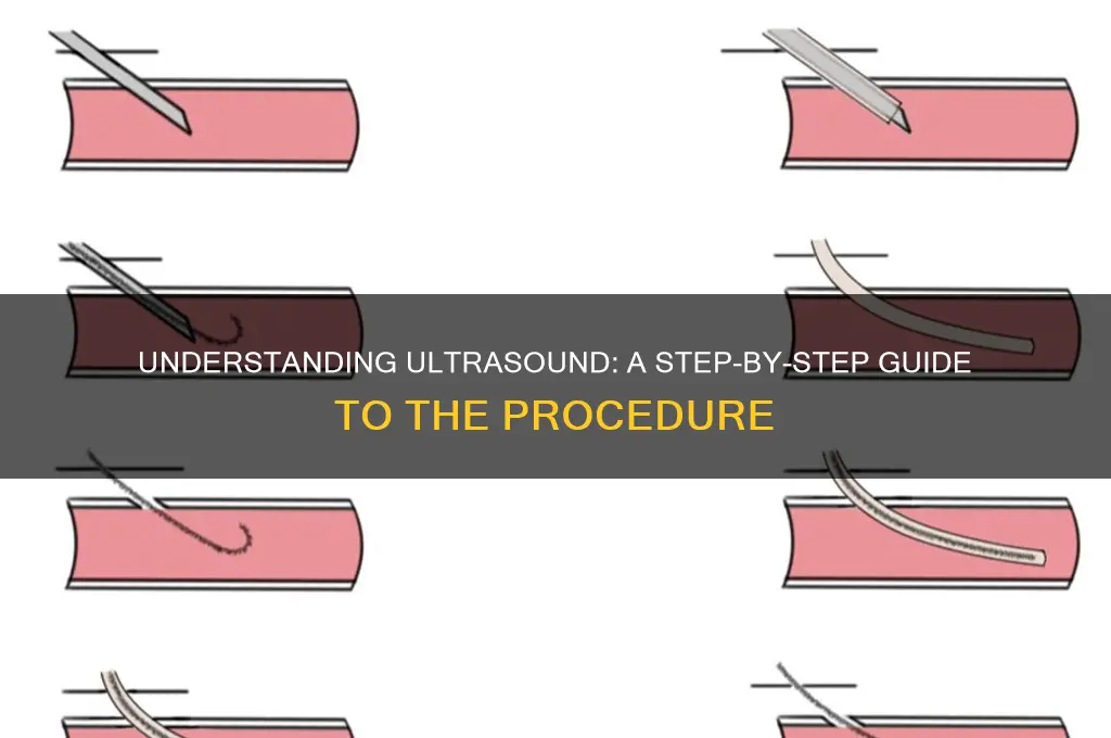 how is ultra sound done