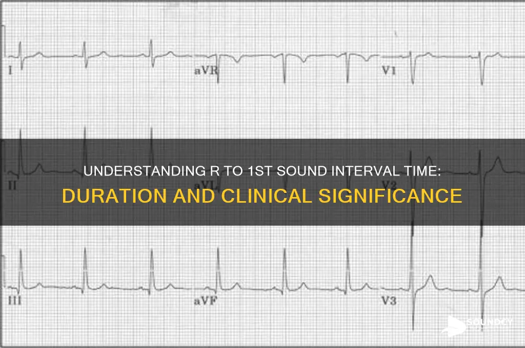 how long is r to 1st sound interval time