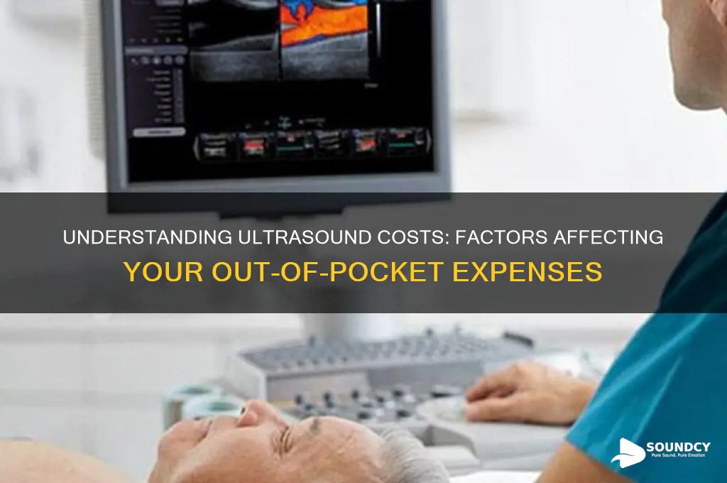 how much are ultra sounds