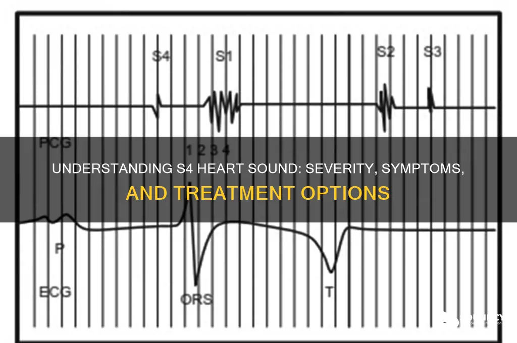 how serious is s4 heart sound