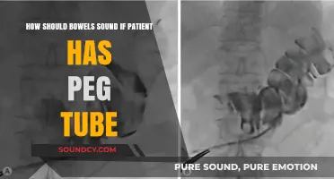 Understanding Bowel Sounds in Patients with PEG Tubes: What’s Normal?