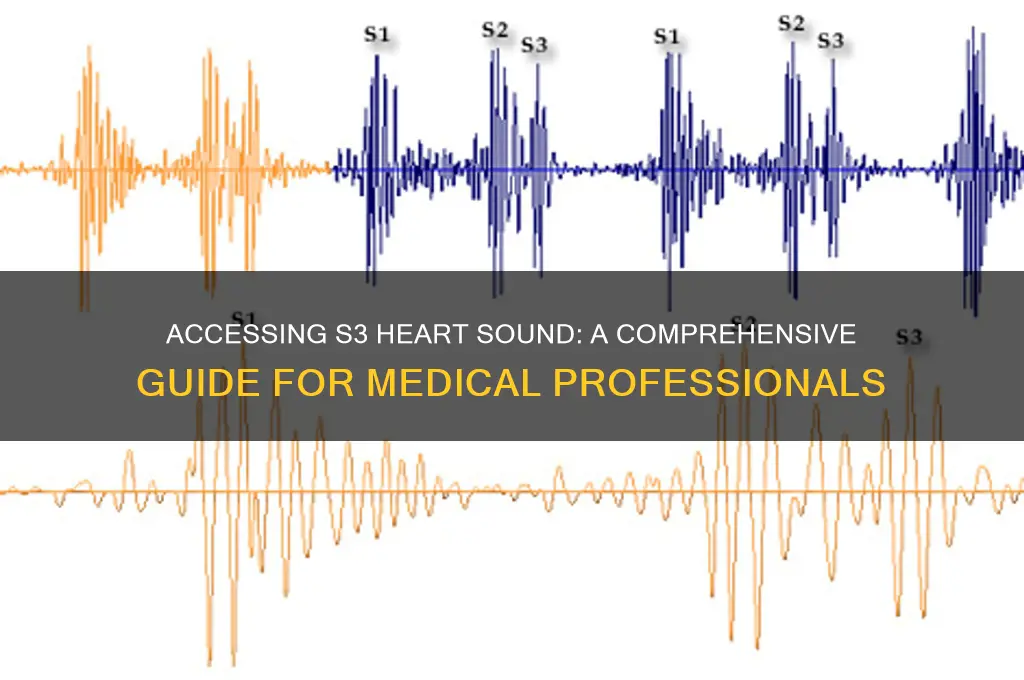 how to access s3 heart sound