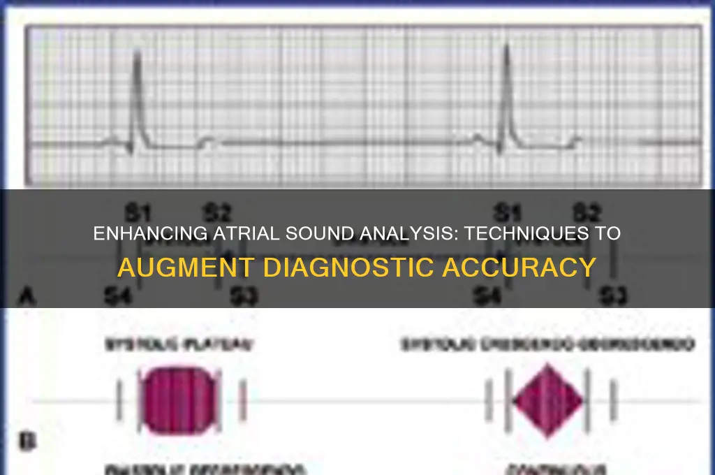 how to augment atrial sounds
