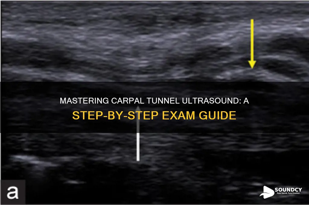 how to do a carpal tunnel ultra sound exam