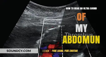 Decoding Your Abdominal Ultrasound: A Step-by-Step Guide