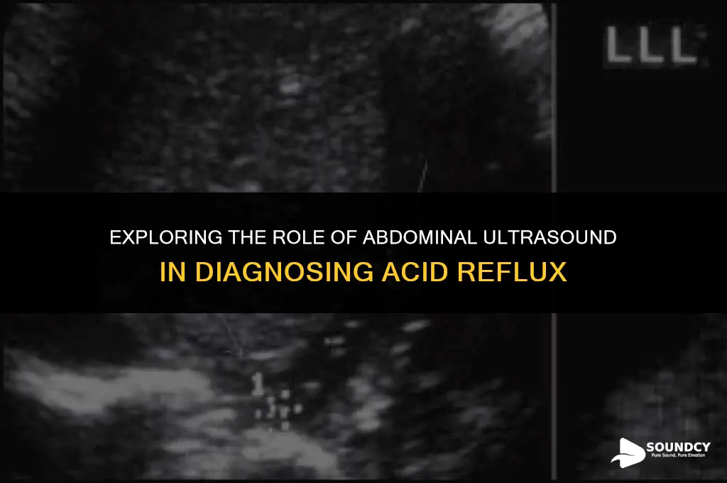is abdominal ultra sound helpful to diagnos acid reflux