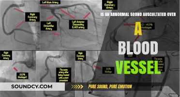 Understanding Abnormal Sounds Auscultated Over Blood Vessels