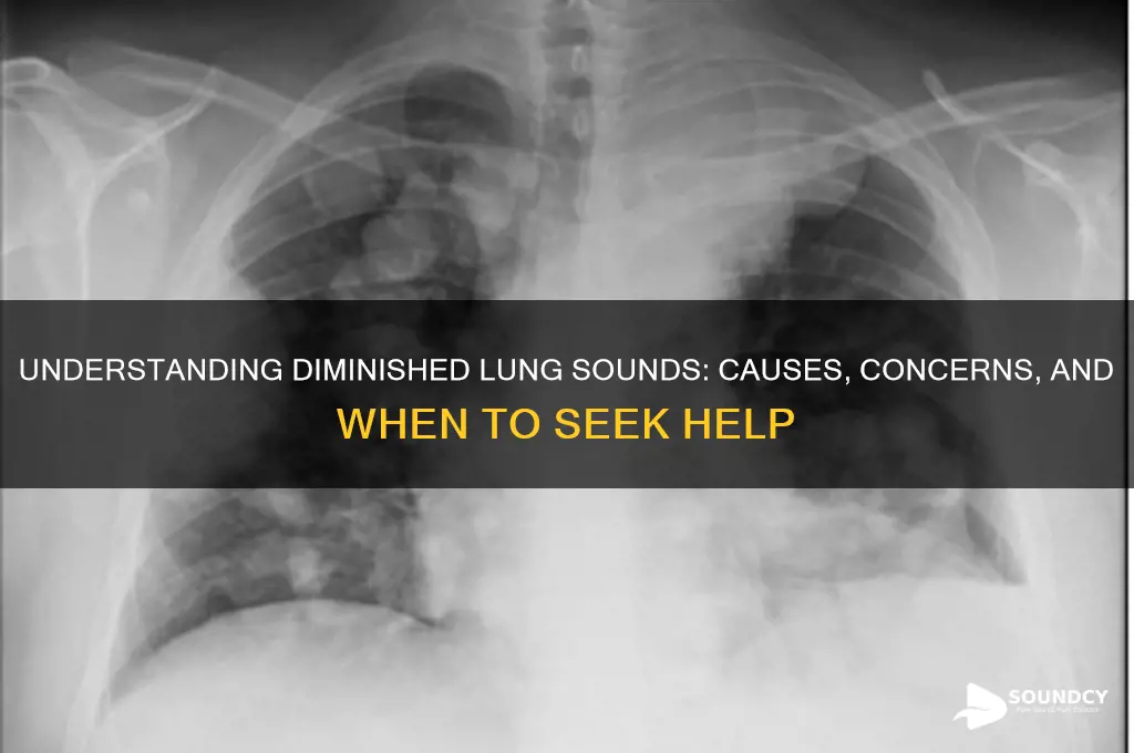 is diminished lung sounds bad