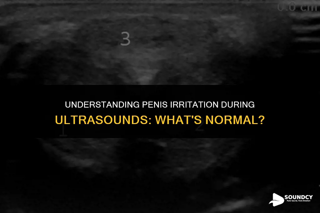 is it normal for penis irritation while ulta sound