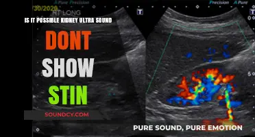 Can Kidney Ultrasounds Miss Stones? Exploring the Possibilities