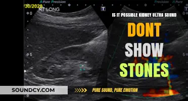Can Kidney Ultrasounds Miss Stones? Exploring the Possibilities