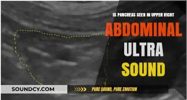 Can the Pancreas Be Spotted in an Upper Right Abdominal Ultrasound?