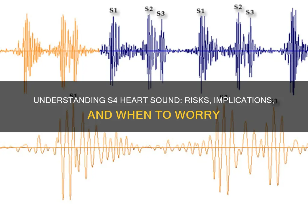 is s4 heart sound dangerous