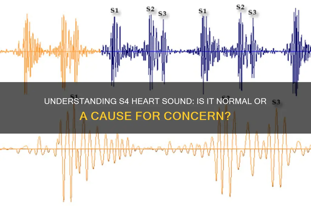 is s4 heart sound normal