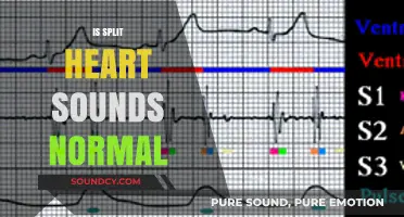 Understanding Split Heart Sounds: Normal or Cause for Concern?