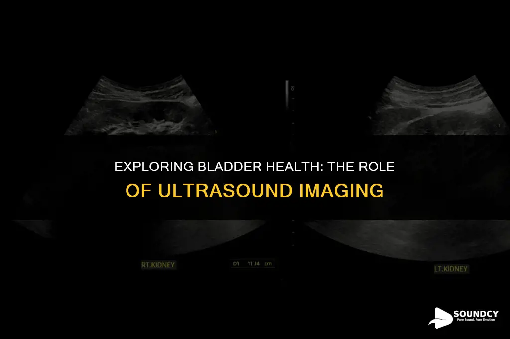 is there a special ultra sound for the bladder