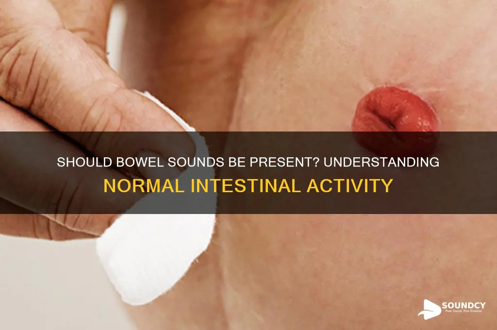 should bowel sounds be present