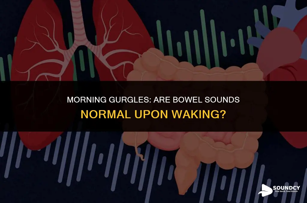 should there be bowel sounds when you wake up