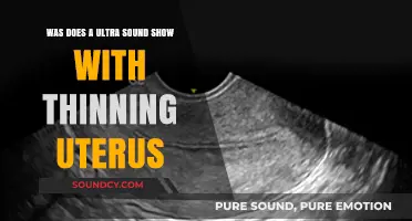 Understanding Ultrasound Results: Thinning Uterus Explained