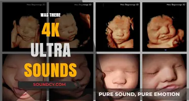 Exploring the Evolution of Ultrasound Technology: Was 4K Ultra Sound Possible?