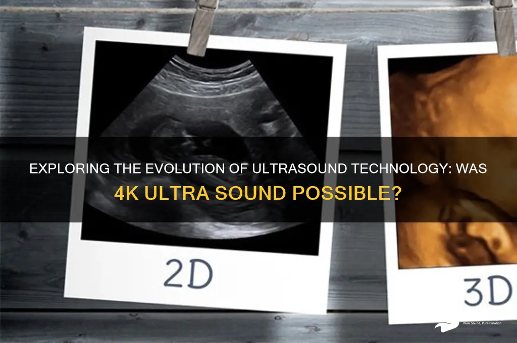 was there 4k ultra sounds