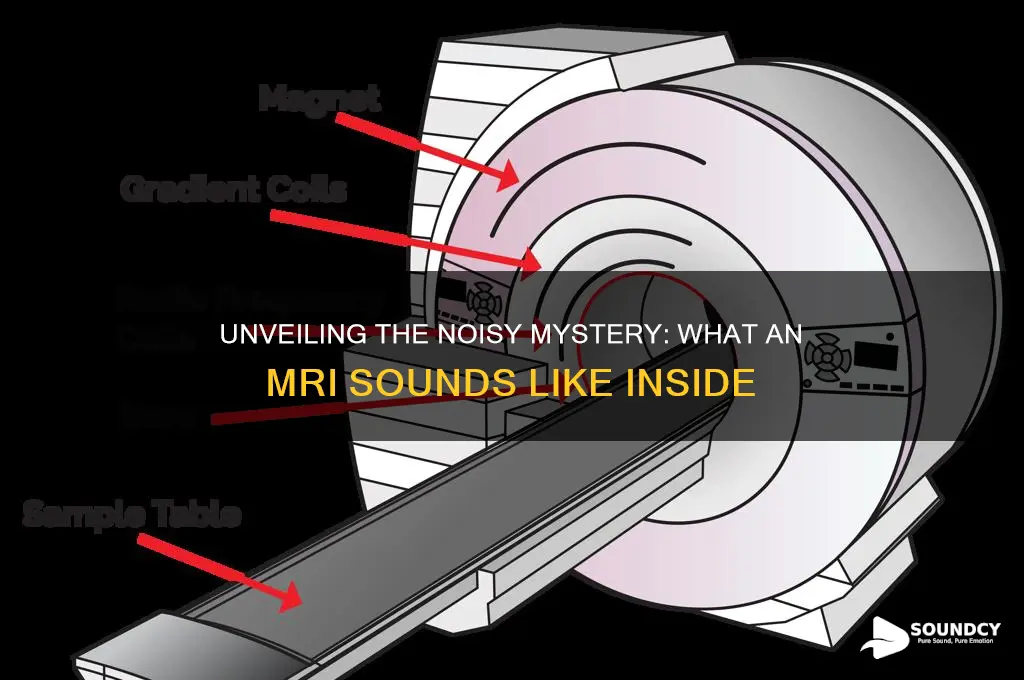 what an mri sounds like
