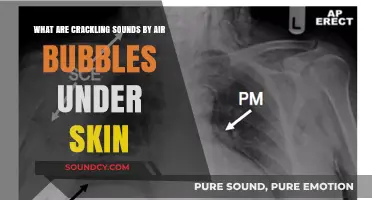 Understanding Crackling Sounds: Air Bubbles Beneath the Skin Explained