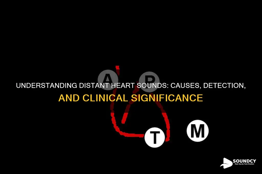 what are distant heart sounds